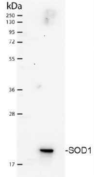 SOD1 aa 43-57 | superoxide dismutase 1, soluble in the group Antibodies Human Cell Biology / Oxidative stress at Agrisera AB (Antibodies for research) (AS09 536)